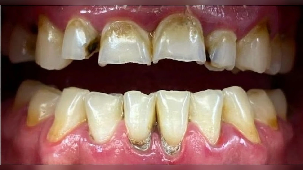Antes — Diseño de sonrisa