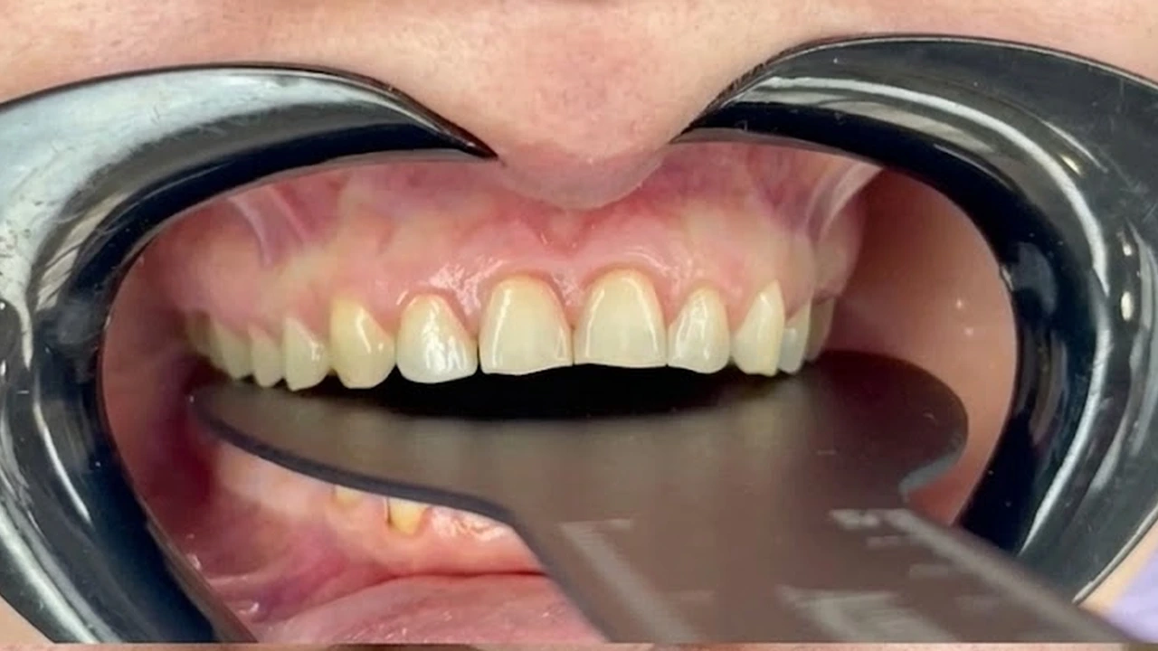 Antes — Diseño de sonrisa avanzado
